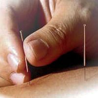 acupunctuur (2)